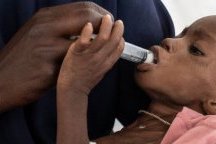 La faim dans le monde est concentrée dans seulement dix pays
